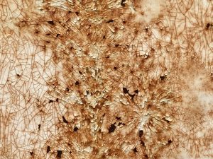 Read more about the article 塵蟎過敏｜塵蟎過敏沒控制會讓症狀惡化嗎？